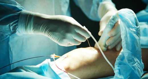 Peripheral Artery Disease (PAD) Treatment